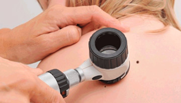 Servicio de Dermatología en Guayaquil